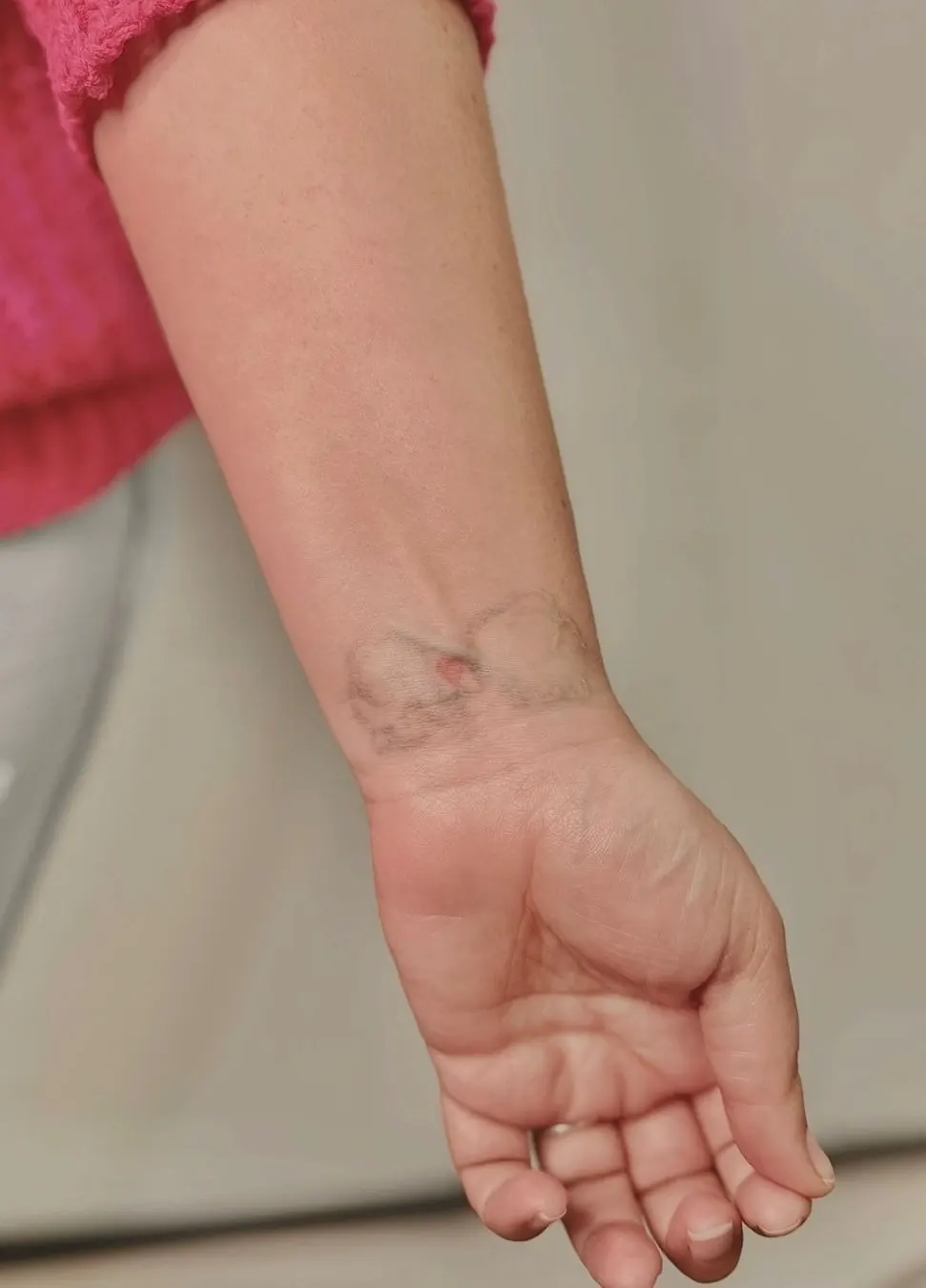 Jardim Silvestre — Transformação — tatuagem original antes da cobertura